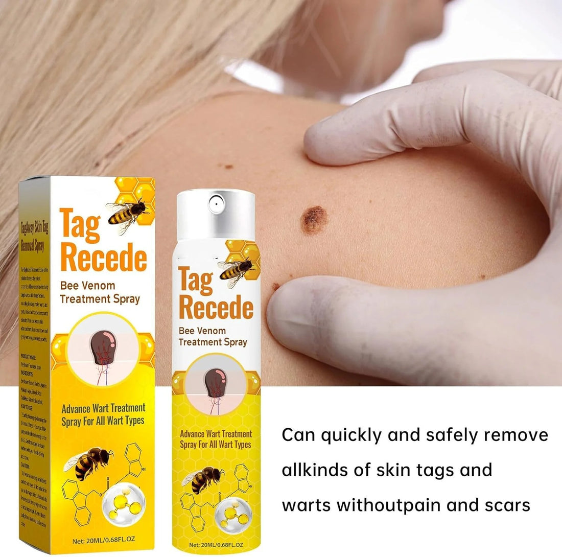 Tag Recede Bee Venom Repair Spray – Wart & Skin Tag Remover | 20ml